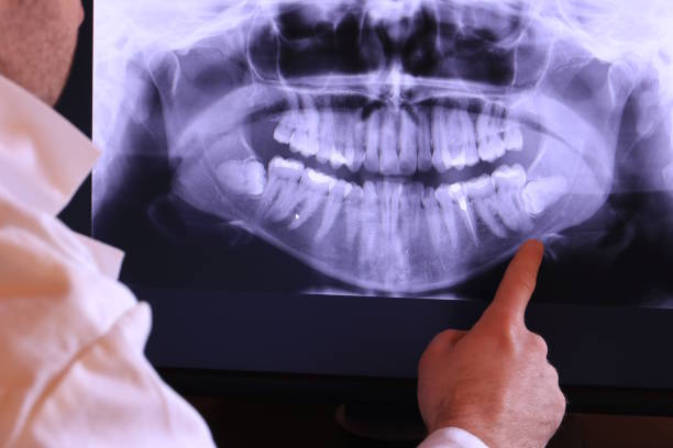 Best Pediatric Emergency Dentist in Jamestown, CA