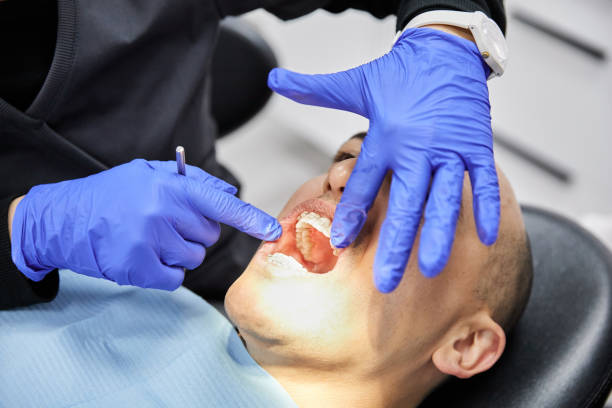 Best Emergency Dentist for Lost Fillings or Crowns in Jamestown, CA