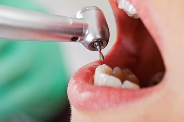 Best Emergency Dentist for Special Needs Patients in Jamestown, CA